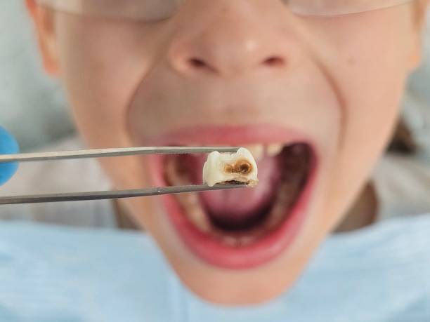 Best Emergency Dental Filling Replacement  in Edna, TX